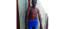 Kombi driver's hands burnt with cigarette lighter by employer