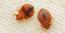 Bedbugs infestation in Bulawayo not severe