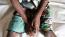 Zimbabwe tightens Mpox surveillance at borders