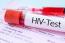 Toxic sexual relationships fuel HIV infection
